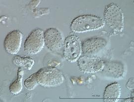  urediniospores of  U. monstericola 
